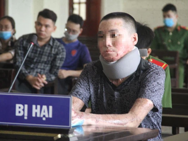 Tạt xăng đốt cháy đồng nghiệp cũ vì chậm trả nợ 2,5 triệu đồng
