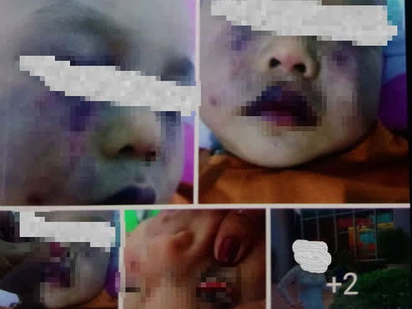 Nghi vấn điểm giữ trẻ không phép bạo hành dã man trẻ 18 tháng tuổi
