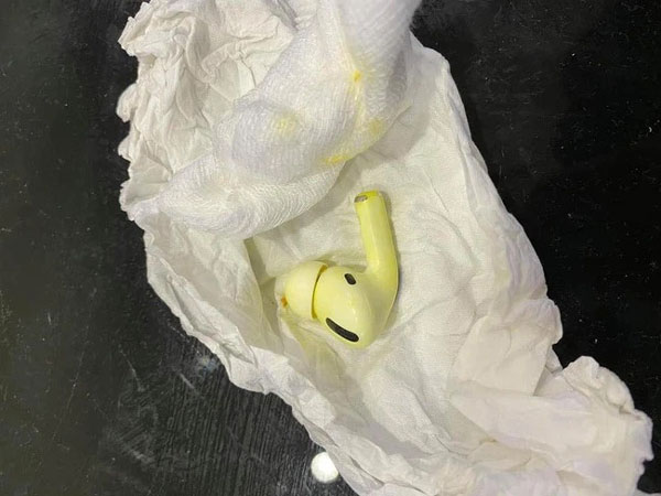 Video call với bạn gái rồi ngủ quên, sáng ra chàng trai mơ màng nuốt luôn tai nghe AirPods Pro vào bụng một cách 'ngon lành'
