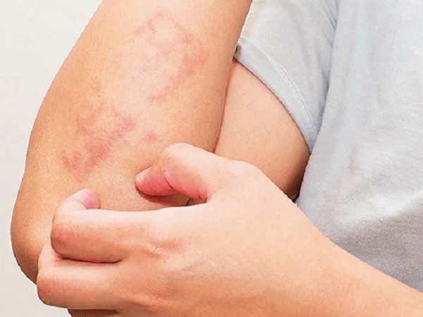 Dấu hiệu trên da cảnh báo nhiều loại ung thư