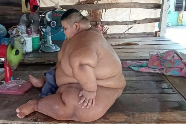 Bi kịch của cậu bé béo nhất Thái Lan: 13 tuổi đã nặng 200kg, từ bé bị ép ăn cho 'chóng lớn' và hậu quả đáng thương gây ám ảnh