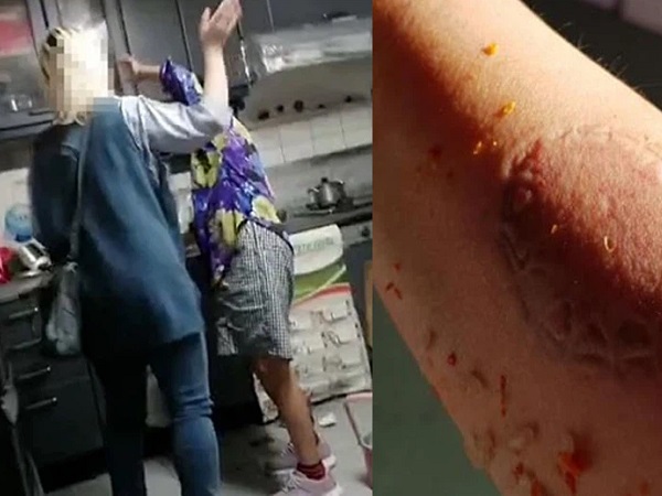Vừa tố mẹ chồng cắn và tạt dầu ớt, cựu tiếp viên hàng không bỗng châm lửa đốt chết chồng, hé lộ tình tiết 'giật gân' làm dư luận choáng váng