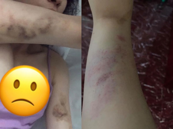 Bị bạn gái chia tay vì không hợp, thanh niên đập cửa từng nhà tìm rồi đánh đập thậm tệ: 'Tao bắt mày phải yêu tao cho tới khi tao có bồ mới!'