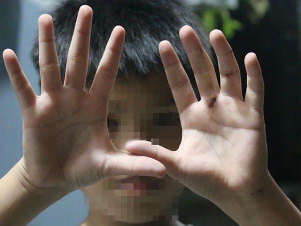 Có hay không bé trai ở Hóc Môn bị cha ruột đánh nát tay, bắt đi bán vé số?