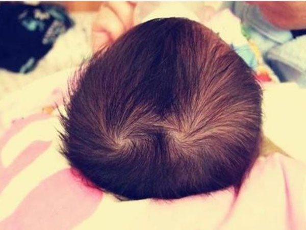 Tại sao số xoáy tóc trên đầu trẻ lại khác nhau?