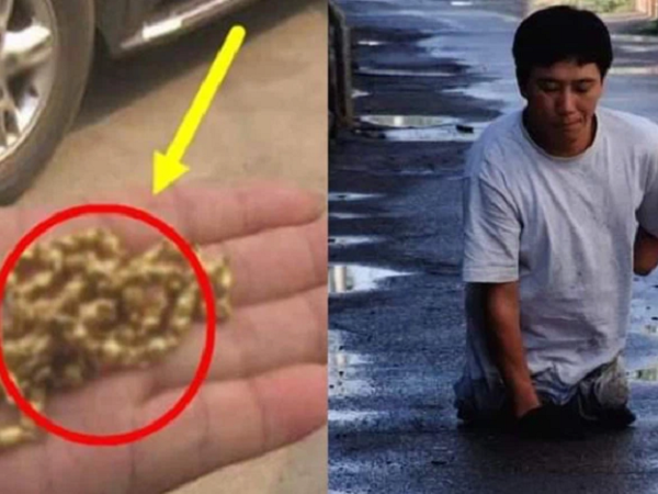 Nhặt 'chùm chìa khóa' rồi vô tư bỏ vào túi, thanh niên bị cắt cụt cả tay chân, không ngờ phải trả giá bằng sự giày vò suốt 23 năm