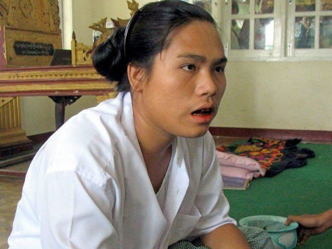 Chuyện khó tin: Cô gái Myanmar mọc 'vật lạ' và biến thành đàn ông sau một đêm