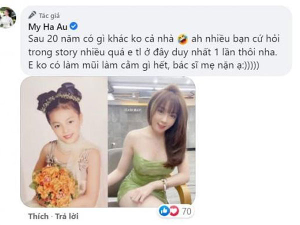 Bị đồn phẫu thuật thẩm mỹ, giảng viên hot girl Âu Hà My nói gì?