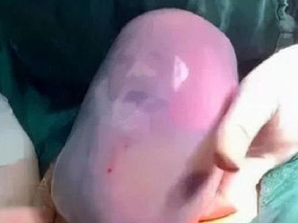 Thấy con chào đời, bố sợ không dám bế nhưng bác sĩ lại chúc mừng