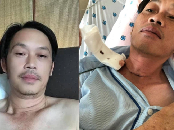 Hoài Linh vừa lộ chuyện bị K tuyến giáp, dân mạng lập tức chỉ ra sự bất nhất vào ngày nam nghệ sĩ phẫu thuật, tuy nhiên câu trả lời cuối cùng sẽ khiến nhiều người phải suy nghĩ lại
