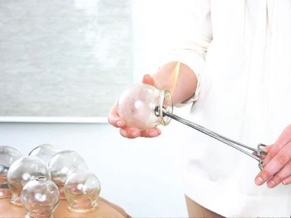 Giác hơi giúp giảm đau nhức, mệt mỏi, đả thông kinh mạch nhưng có 3 nhóm người tốt nhất không nên thử nếu không muốn bệnh thêm trầm trọng