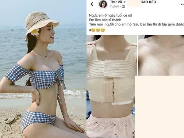 Xôn xao lộ ảnh 'độ' vòng 1 của diễn viên Về Nhà Đi Con