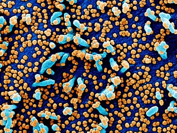 Phát hiện 2 con virus 'anh em' với Covid-19: 'Quái vật' 4 trong 1, nhảy từ động vật sang người