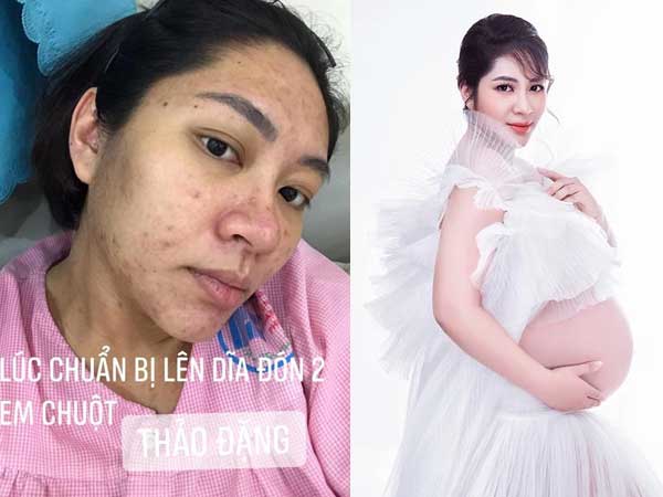 Hoa hậu Đặng Thu Thảo tự khoe ảnh nhan sắc tàn phá và mụn mọc chi chít sởn da gà vì bầu bí, thái độ tích cực thật đáng khâm phục!