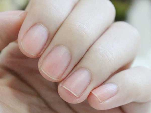 Người có mạch máu thông suốt, khỏe mạnh thường có chung 3 dấu hiệu nhỏ này ở ngón tay: Nếu có đủ, bạn có tiềm năng trường thọ rất cao!
