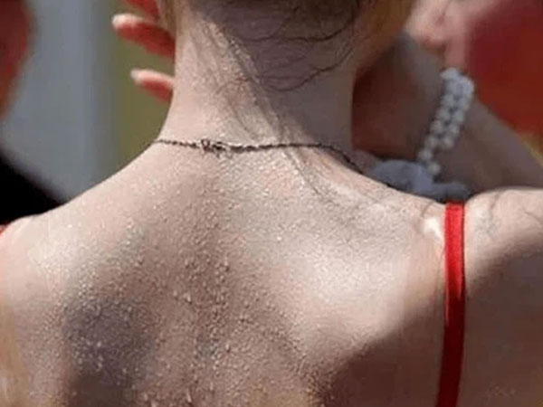 6 bộ phận trên cơ thể đổ nhiều mồ hôi đang cảnh báo bệnh tật, trong đó có cả dấu hiệu đột quỵ, đừng bỏ qua