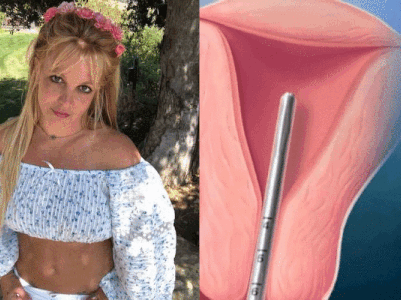 Phương pháp tránh thai mà người giám hộ ép Britney Spears phải dùng, không cho cô sinh thêm con là gì?