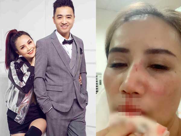 Phỏng vấn nóng cô Xuyến (Về Nhà Đi Con) vụ bị chồng cũ bạo hành: 'Anh ta nói sẽ rạch mặt, tạt axit nếu tôi có người mới, lấy hết tiền đánh bạc'