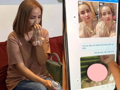 Hoàng Yến xuất hiện trong họp báo với gương mặt băng bó sau khi bị chồng cũ đánh gãy mũi