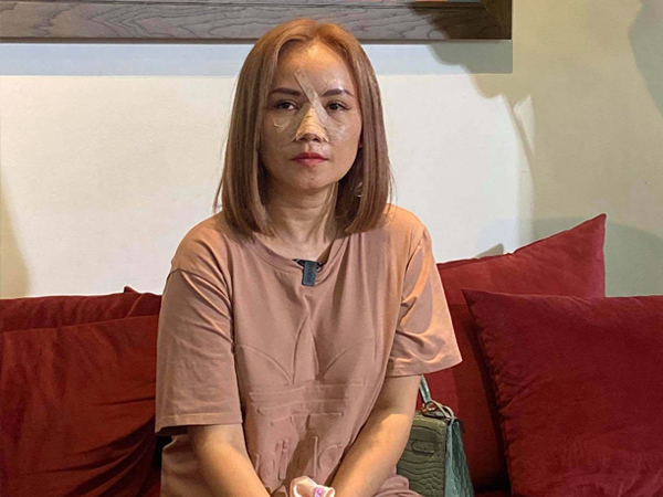 Hoàng Yến băng bó mặt, sợ hãi: 'Tôi bật dậy thì thấy anh ta cầm con dao dí vào mặt mình'