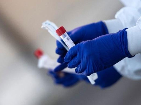 TP.HCM: Dự kiến triển khai 200.000 xét nghiệm kháng nguyên nhanh virus SARS-COV-2 trong 1 ngày
