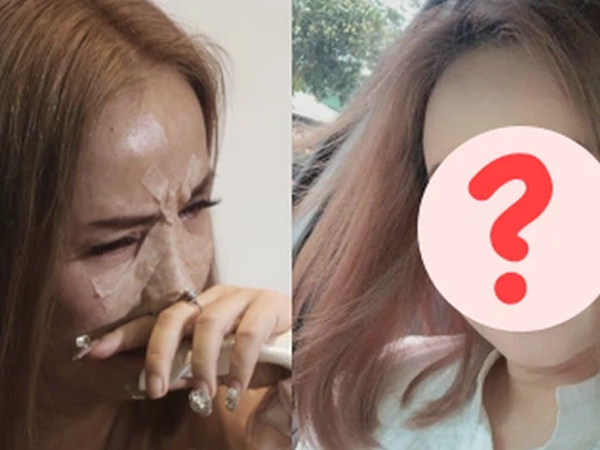Bị chồng cũ hành hung đến gãy cả sống mũi, đây là diện mạo hiện tại của 'Cô Xuyến' Hoàng Yến!