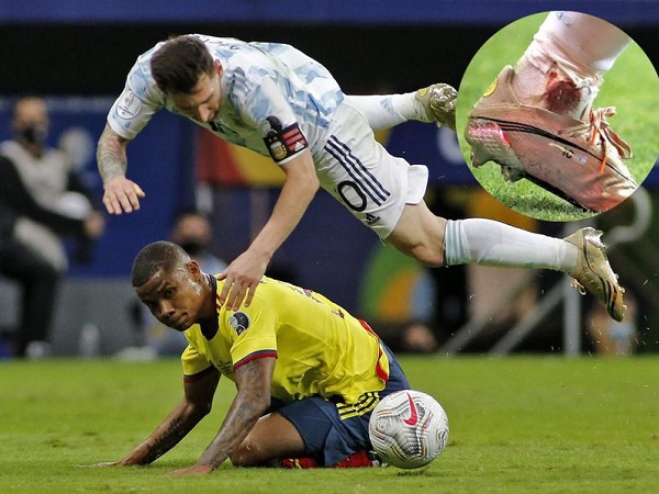 Chân rướm máu, Messi vẫn đưa Argentina vào chung kết Copa America
