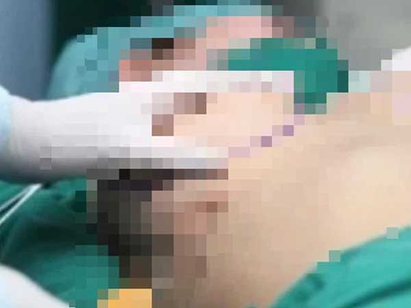 Vụ bác sĩ thẩm mĩ chở cô gái tử vong sau khi nâng ngực đến trại hòm nhờ mai táng: Đã bàn giao thi thể cho người nhà mai táng