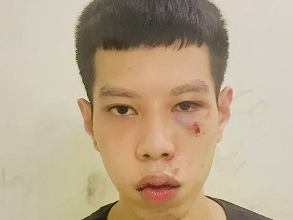 Bắt giữ thanh niên Hà Nội cướp 16 triệu của cụ bà vừa lĩnh lương hưu