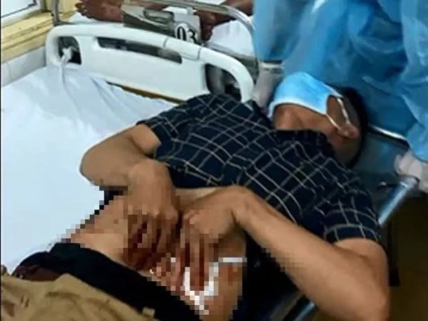 Hỗn chiến kinh hoàng ở cảng cá Quy Nhơn, 5 người bốc vác bị chém trọng thương