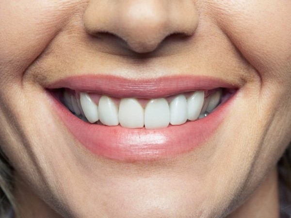 10 mẹo điều trị viêm lợi tại nhà cực kỳ hiệu quả