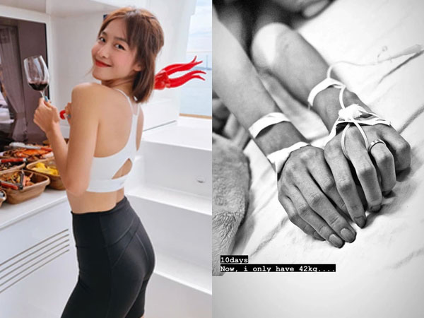 Khả Ngân 'Hậu duệ mặt trời' bản Việt gây hoang mang khi tiết lộ 2 tay chằng chịt kim tiêm, sút cân trầm trọng và ho ra máu