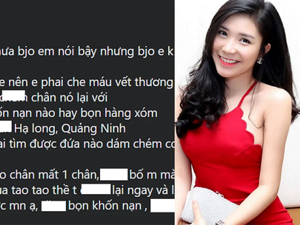 Thanh Bi bức xúc, treo thưởng truy tìm kẻ chém mất 1 chân chú chó cưng