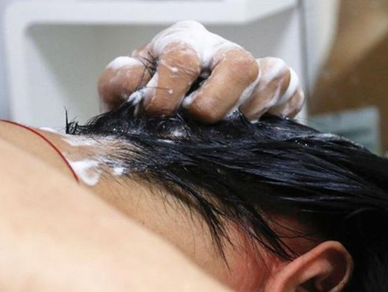 3 thói quen 'hành hạ' thận của nhiều người trẻ nguy hiểm hơn cả hút thuốc, uống rượu, nên bỏ ngay