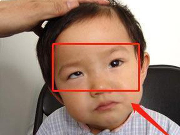 Bé trai 5 tuổi mắt thâm đen, con ngươi 1 bên gần như biến mất, tất cả chỉ vì thói quen độc hại này