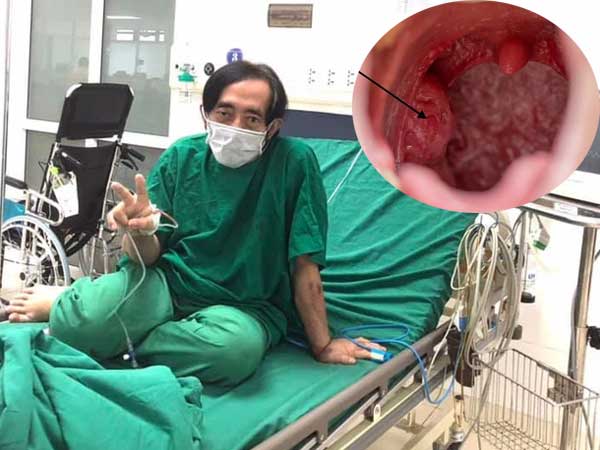 Căn bệnh ung thư cướp đi sinh mạng của nghệ sĩ Giang Còi: Người trẻ cũng có nguy cơ mắc phải chỉ từ những thói quen phổ biến