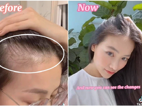 6 tháng kiên trì gội đầu bằng thứ nước này, Hoa hậu Phương Khánh nhận kết quả cực ưng với tóc con mọc tua tủa