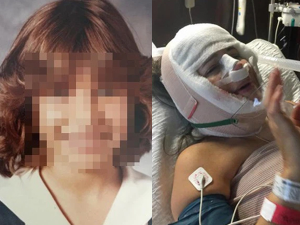 Cả tuổi thơ bị chê 'xấu như quỷ', bà mẹ quyết 'đập đi xây lại' giống Đệ nhất phu nhân Mỹ và kết quả ngoài sức tưởng tượng