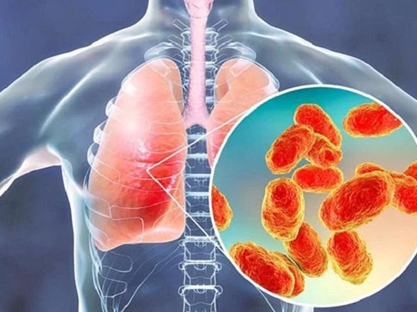 Ca sĩ Việt Quang qua đời vì bệnh viêm phổi do thói quen tắm đêm, làm việc nhiều: Cảnh báo 5 thời điểm nguy hiểm không nên tắm mà người trẻ thường lơ là