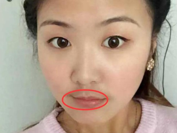 4 biểu hiện trên khuôn mặt cho thấy tử cung đang có vấn đề