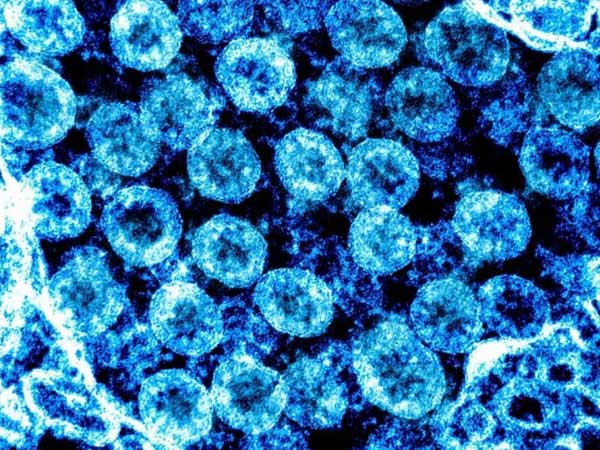 Phát hiện quan trọng về virus SARS-CoV-2 giúp phát triển thuốc chữa Covid-19