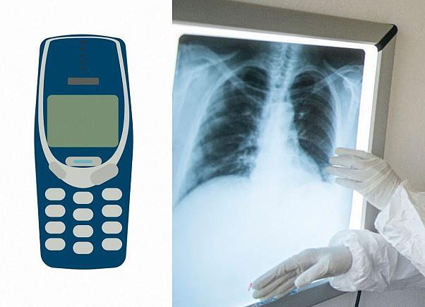 Bác sĩ nội soi lấy điện thoại di động ra khỏi bụng tù nhân