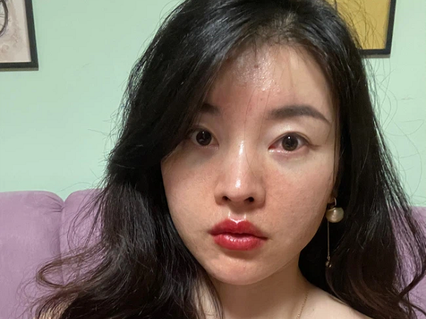Làn da xuất hiện 5 dấu hiệu này thì chứng tỏ bạn đang bị kích ứng với mỹ phẩm đang dùng