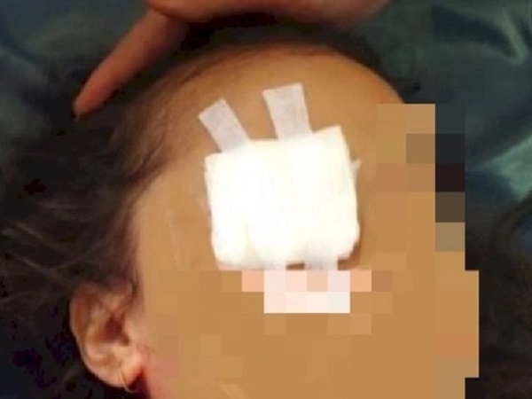Rúng động: Bé gái bị cha mẹ đẻ khoét mắt 'làm lễ' cầu tài lộc, cảnh sát điều tra phát hiện chuyện man rợ