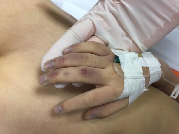Vụ cháu bé 6 tuổi tử vong ở Xuân Đỉnh: Người cha đánh con bằng đũa