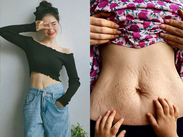 Lần đầu Hoà Minzy khoe cận chiếc bụng bầu đầy vết rạn thâm đen, chỉ những ai làm mẹ mới hiểu hết loạt ảnh khó tin này!
