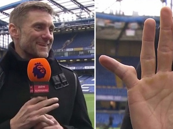 Cựu thủ môn Chelsea khoe ngón tay biến dạng đáng sợ, đồng nghiệp đứng cạnh buông lời nói đùa khiến tất cả im bặt