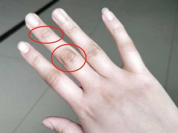 Gan có khỏe hay không, cứ giơ ngón tay giữa lên mà quan sát: nếu không có 4 biểu hiện sau nghĩa là gan khỏe mạnh