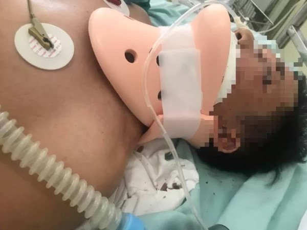 Người đàn ông bị đánh nguy kịch ngay sau bữa nhậu trong trụ sở viện kiểm sát