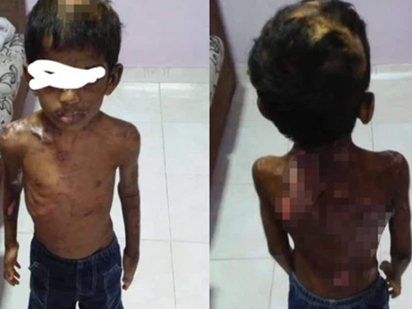 Tin tưởng gửi con cho bảo mẫu, 7 tháng sau người mẹ gặp lại đứa trẻ thân tàn ma dại, trông không khác gì nô lệ